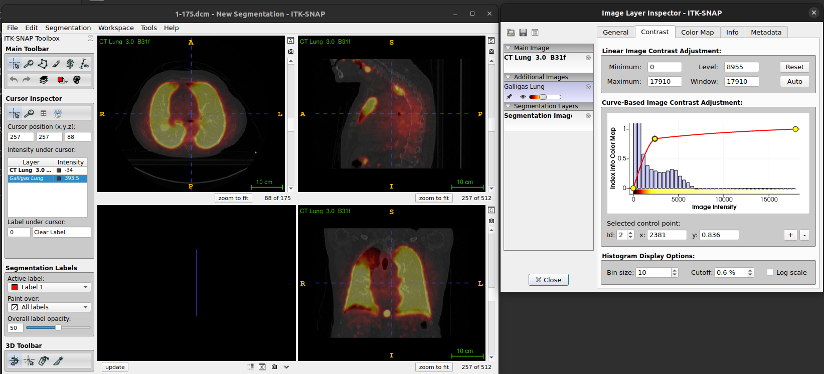 Figure. ITK-SNAP: Layer inspector with contrast tab