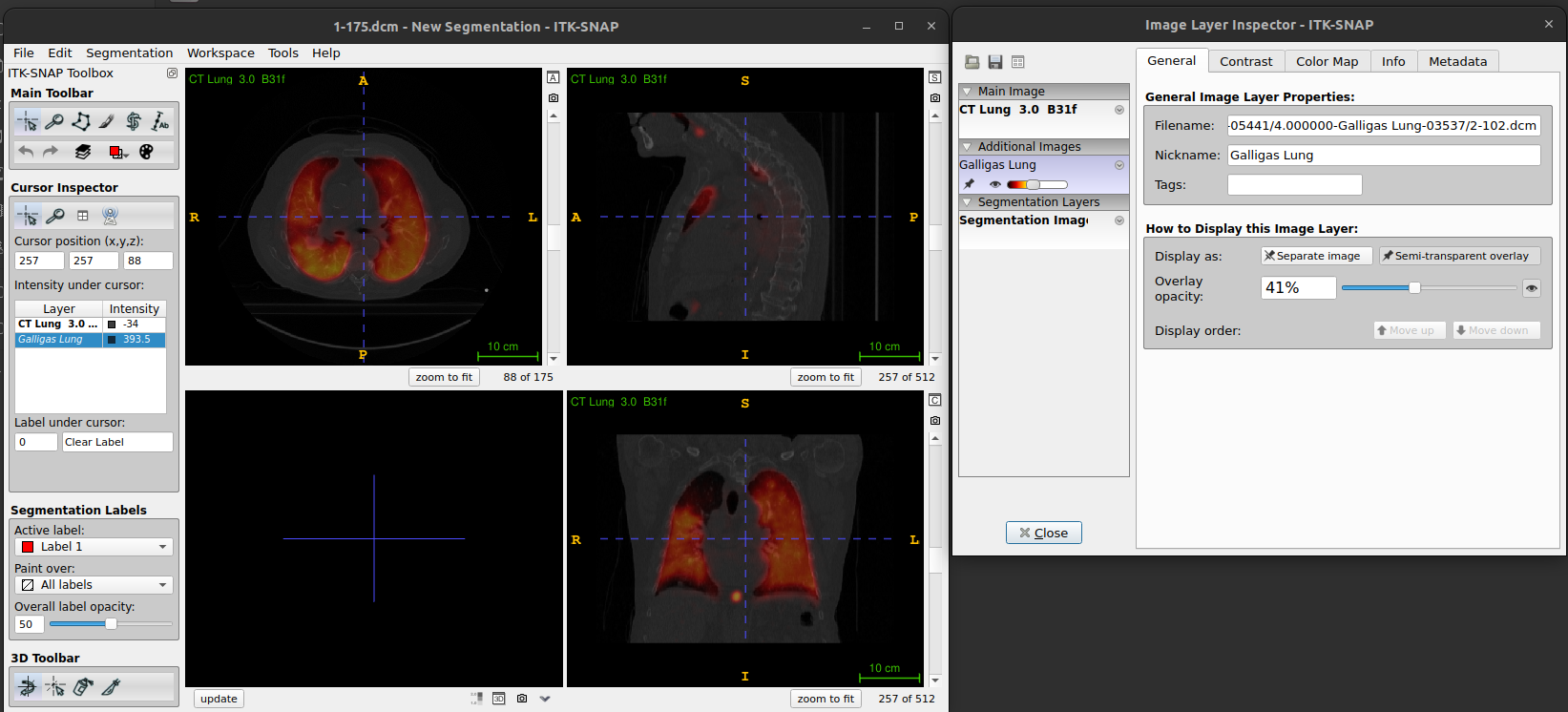 Figure. ITK-SNAP: Layer inspector with general tab