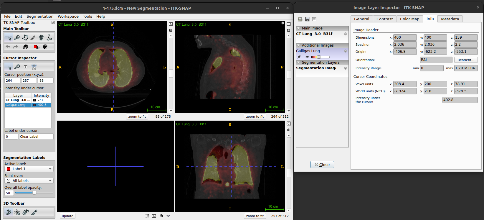 Figure. ITK-SNAP: Layer inspector with info tab