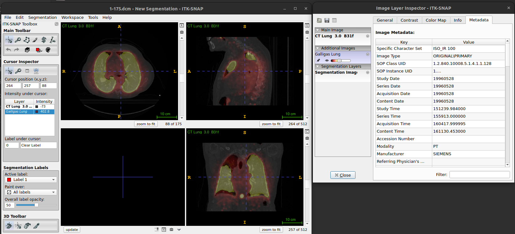 Figure. ITK-SNAP: Layer inspector with metadata tab