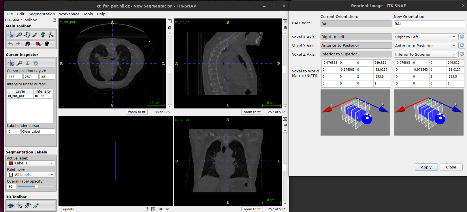 Figure. ITK-SNAP Reorient image