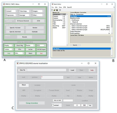 Example of the SPM GUI