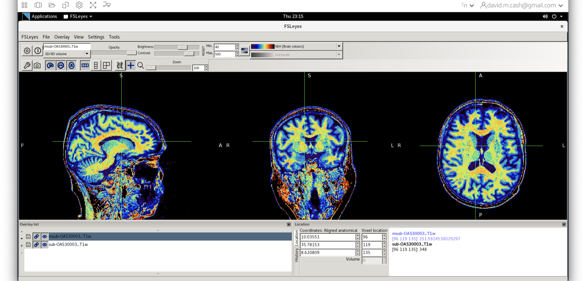 Bias in image using NIH map