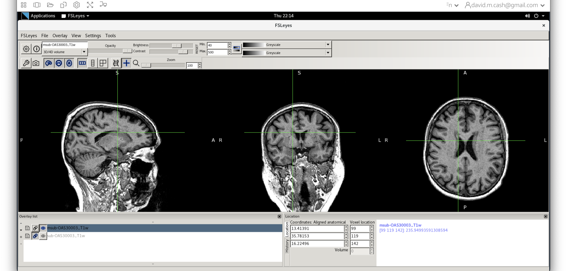 Bias correted image in greyscale