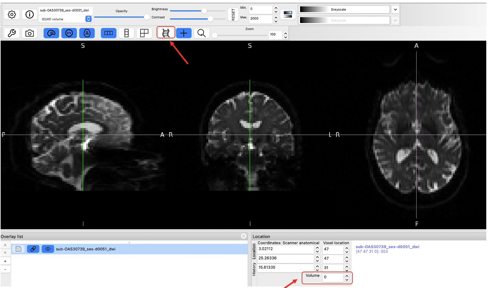 FSLeyes of B0 image