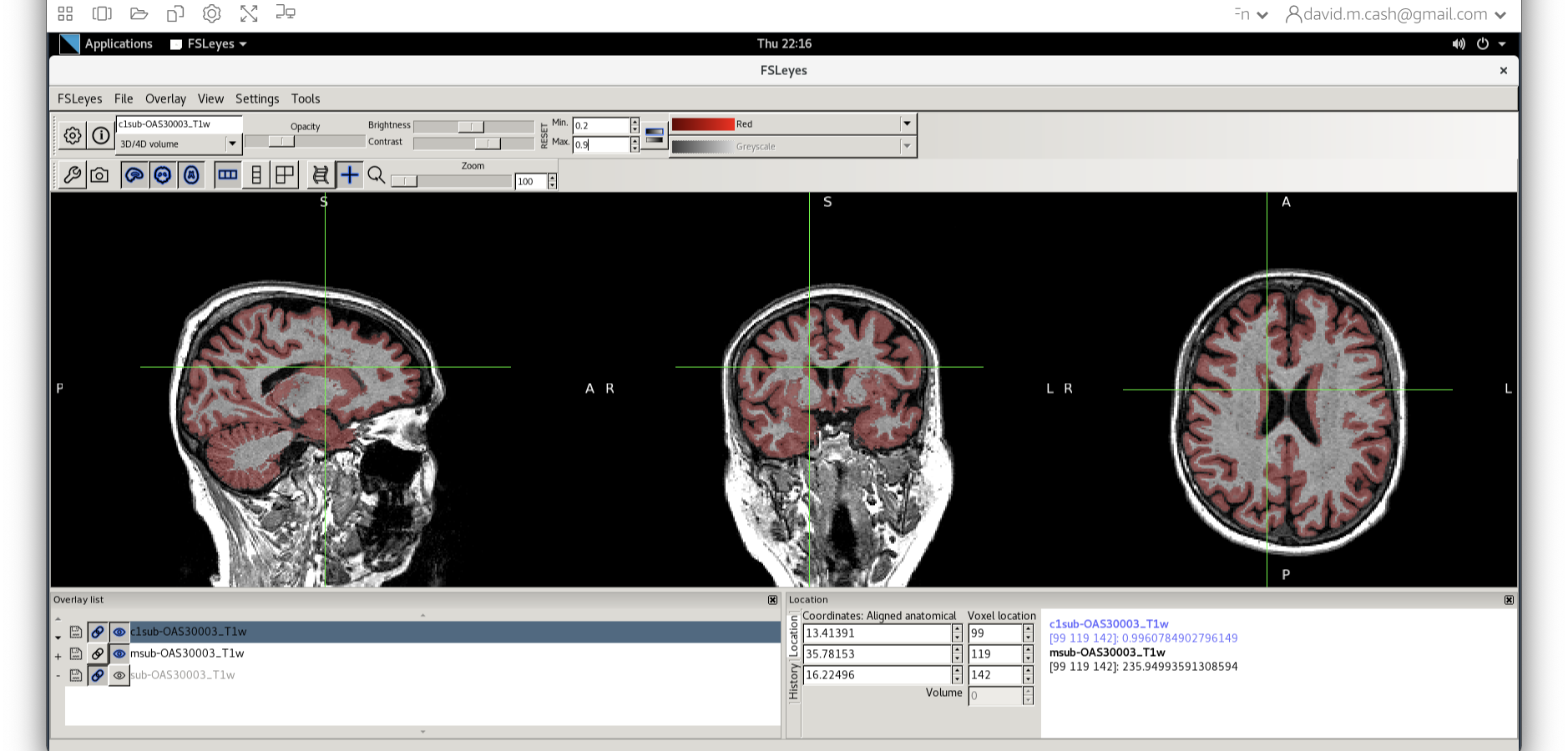 Adding the grey matter image and turning it red