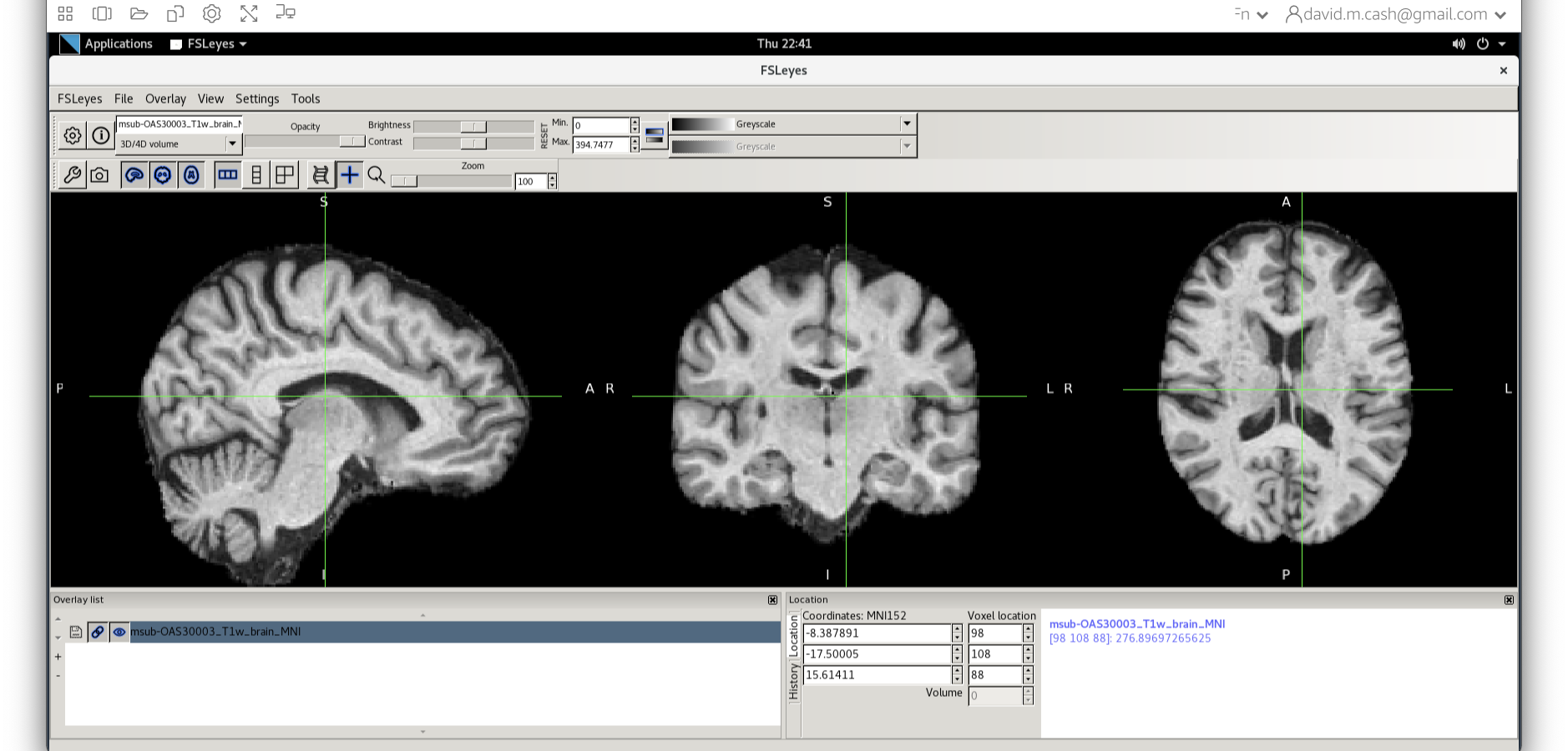 T1 in MNI space