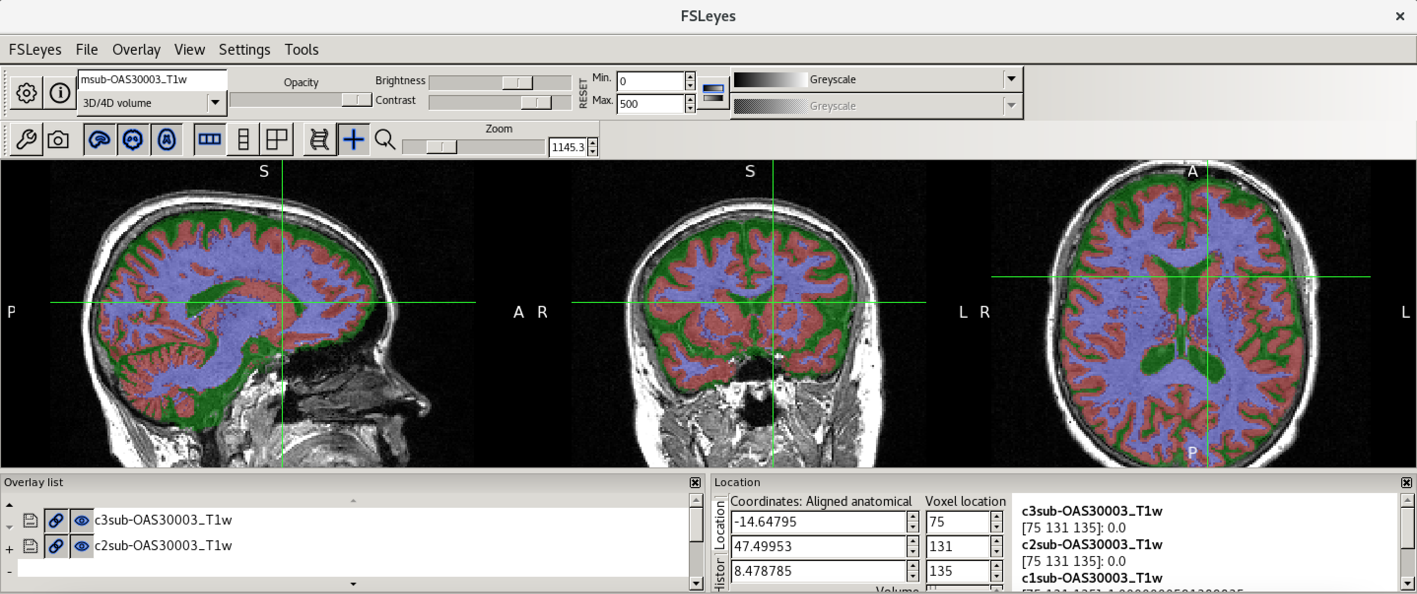 Tissue segmentation check