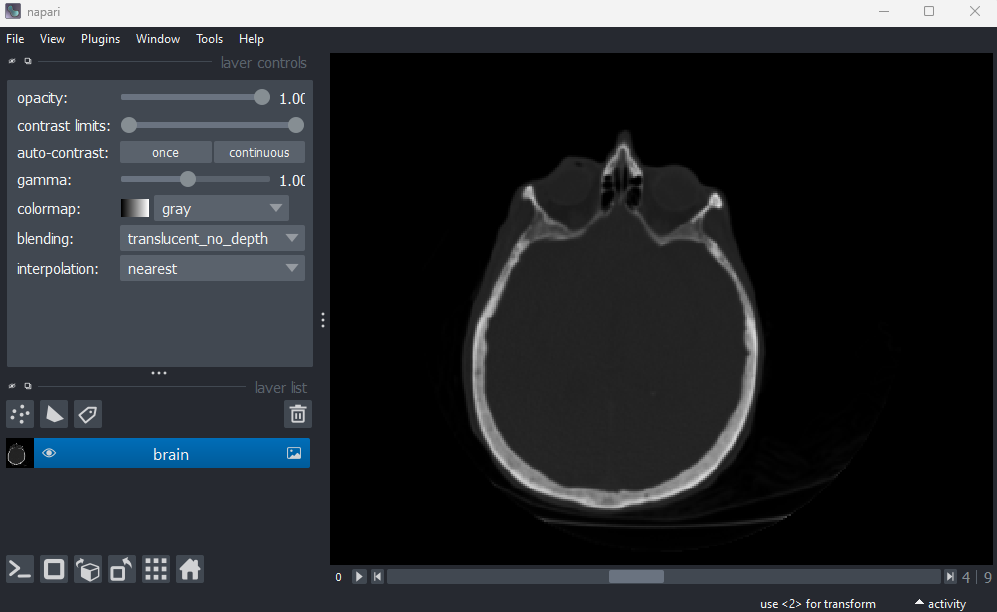 A screenshot of a head X-ray in Napari