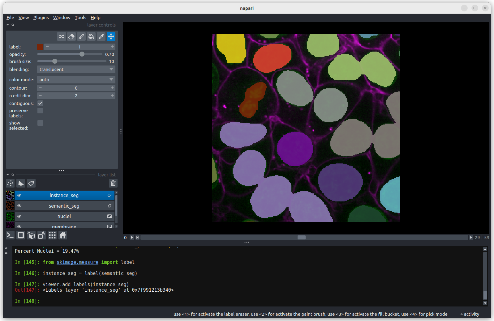 A screenshot of an instance segmentation of nuclei with some incorrectly joined instances.