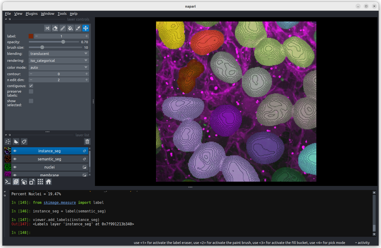 A screenshot of an instance segmentation of nuclei in 3D mode with some incorrectly joined instances.