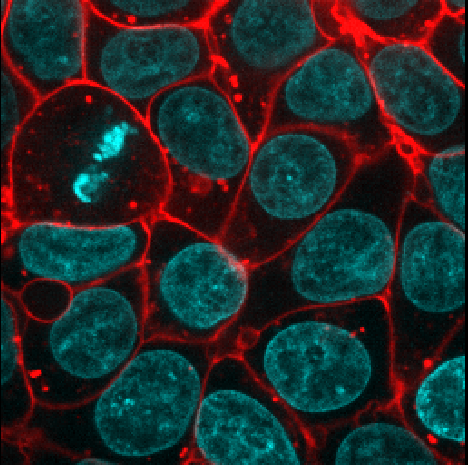 Cells image with blue nuclei and bright  red membranes