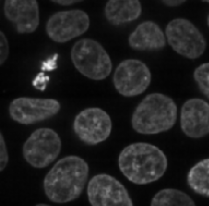 Nuclei image after gaussian blur with sigma  of 1