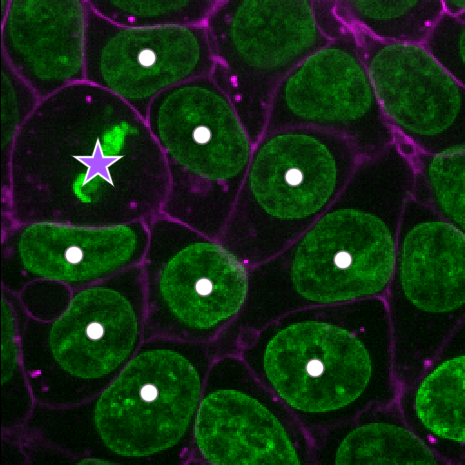 Cells image with points marking multiple nuclei