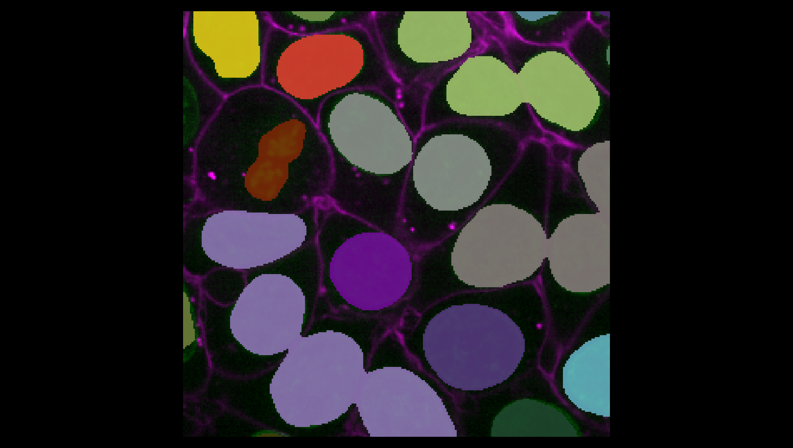 A screenshot of an instance segmentation of nuclei.