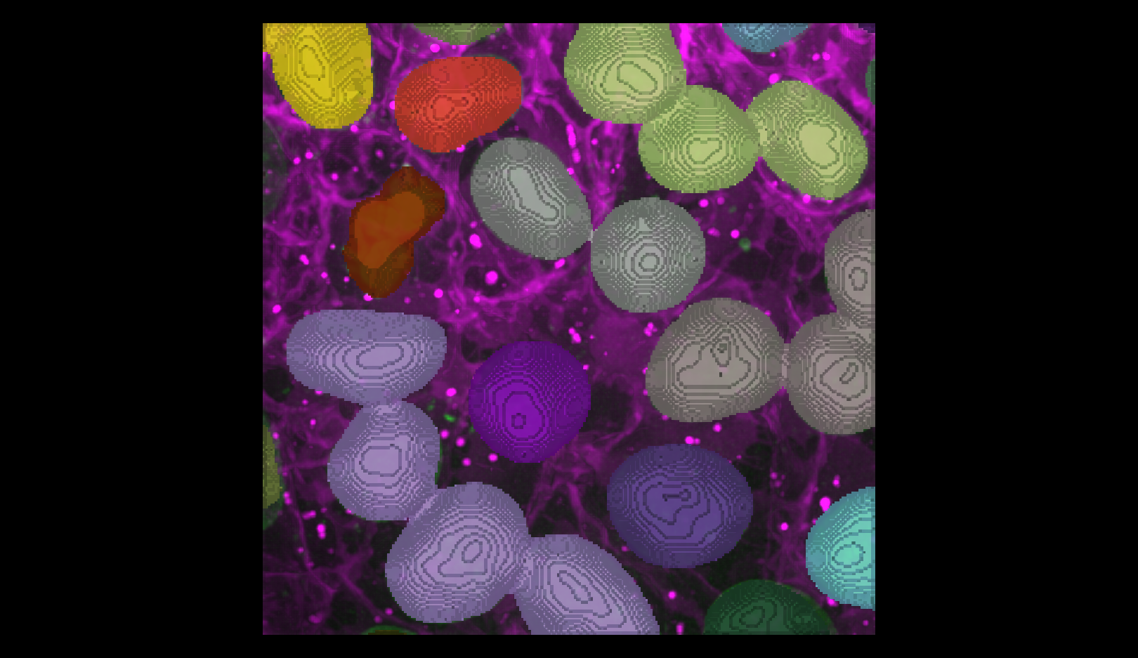 A screenshot of an instance segmentation of nuclei in 3D mode with some incorrectly joined instances.
