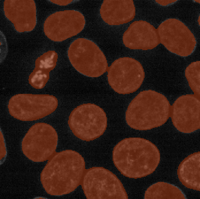 Mask of nuclei (brown) overlaid on  nuclei image - created with manual thresholding after gaussian blur