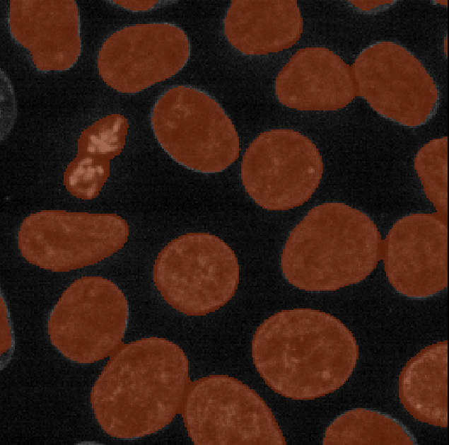 Mask of nuclei (brown) overlaid on  nuclei image - created with Otsu thresholding after gaussian blur