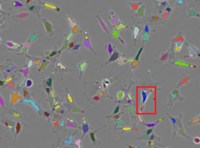 Results from our traditional segmentation pipeline with box around a cell that has been over segmented
