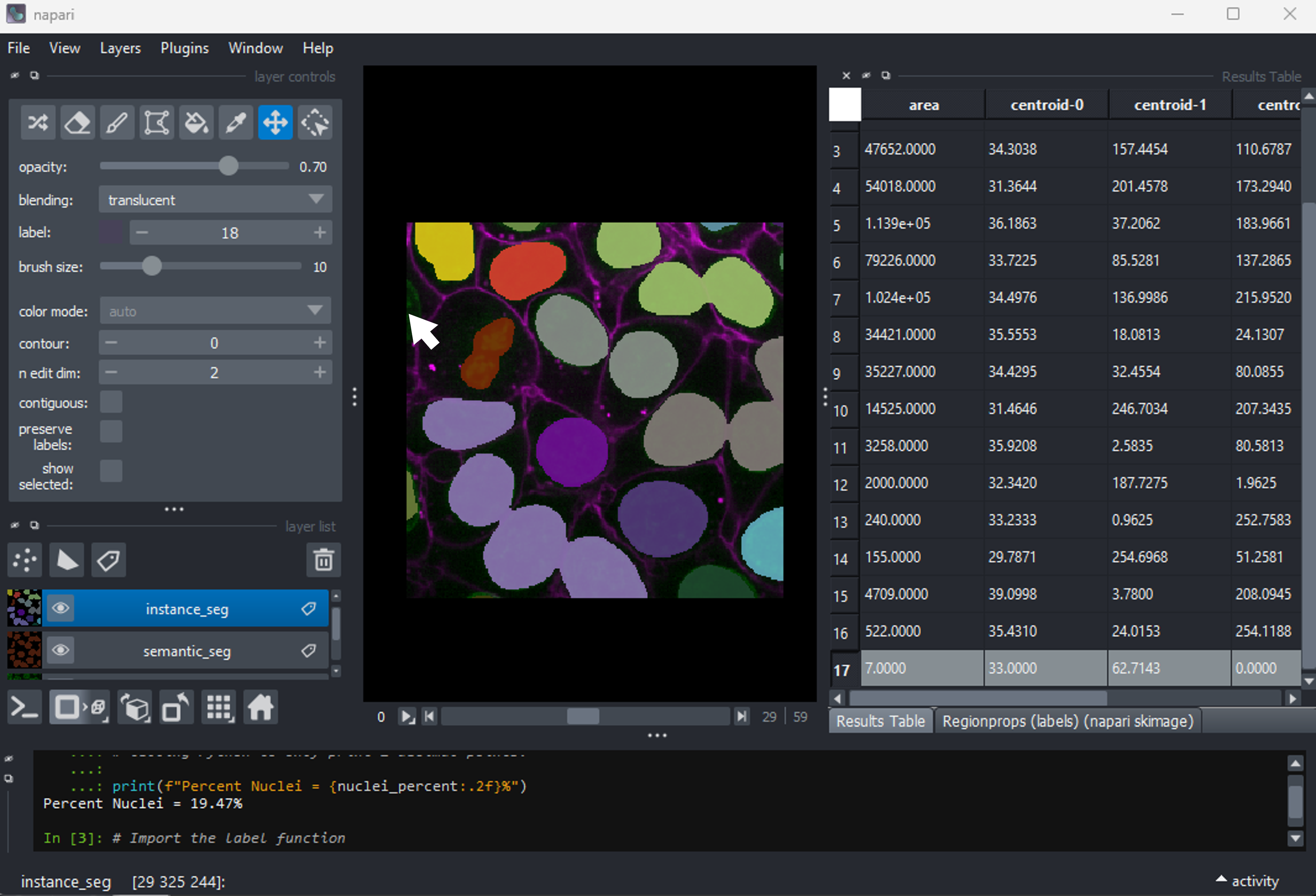 A screenshot region-props dialog highlighting the smallest nucleus.